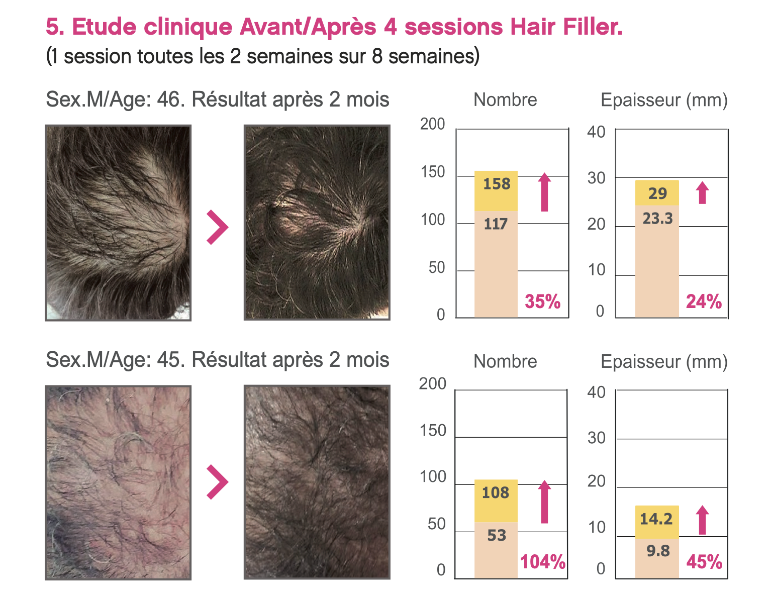 DR CYJ Hair Filler 2x1ml Docteur Filler